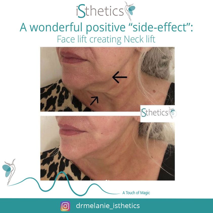 acne and acne scarring, ageing skin, antiageing and wellness, anti